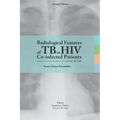 Radiological features of TB in HIV Co-infected Patients. Case book