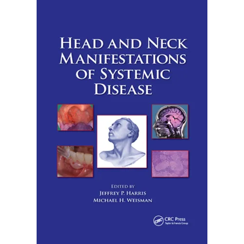 Head and Neck Manifestations of Systemic Disease