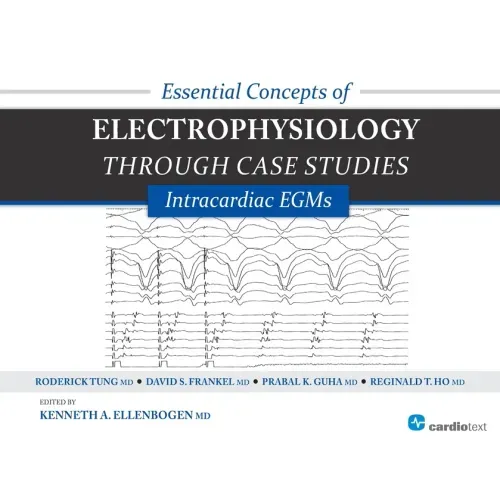 Essential Concepts of Electrophysiology Through Case Studies: Intracardiac EGMs: Intracardiac EGMs