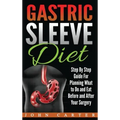 Gastric Sleeve Diet: Step By Step Guide For Planning What to Do and Eat Before and After Your Surgery