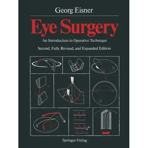 Eye Surgery: An Introduction to Operative Technique
