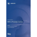 MRI in Prostate Cancer