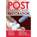 Post Endodontic Restoration