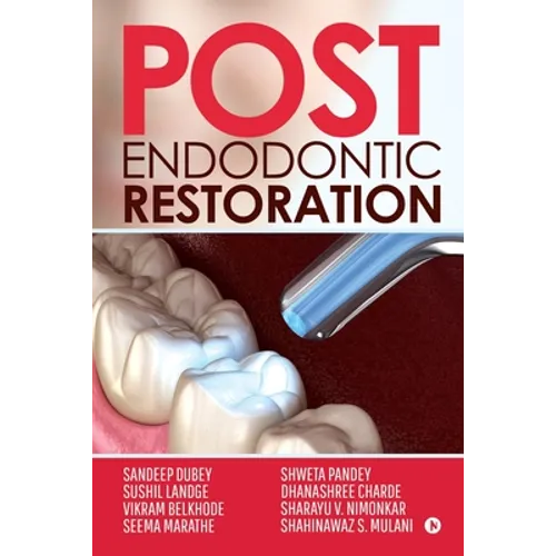 Post Endodontic Restoration
