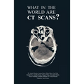 What in the World are CT Scans?