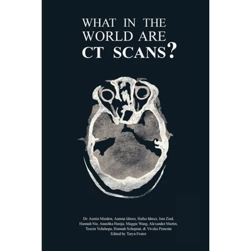 What in the World are CT Scans?