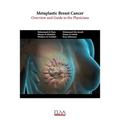 Metaplastic Breast Cancer: Overview and guide to the physicians