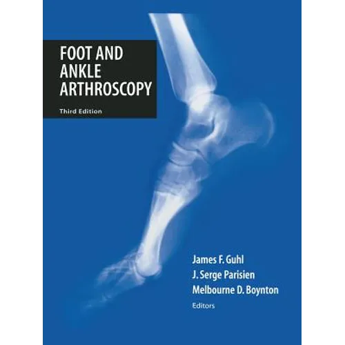 Foot and Ankle Arthroscopy