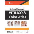 A Handbook of Vitiligo and Color Atlas