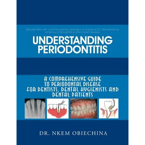 Understanding Periodontitis: A Comprehensive Guide to Periodontal Disease for Dentists, Dental Hygienists and Dental Patients