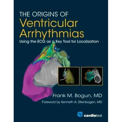 The Origins of Ventricular Arrhythmias: Using the ECG as a Key Tool for Localization