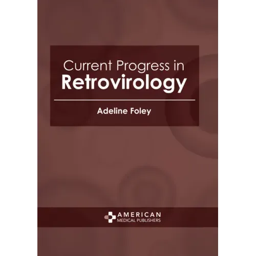 Current Progress in Retrovirology