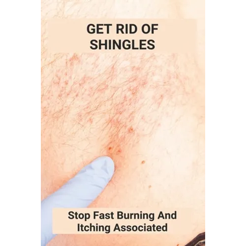Get Rid Of Shingles: Stop Fast Burning And Itching Associated: Shingles On Face Treatment