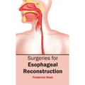 Surgeries for Esophageal Reconstruction