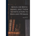 Moles, or Birth-marks, and Their Signification to Man and Woman
