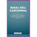 Basal Cell Carcinoma: Finding Your Way Through Diagnosis, Treatment, and Beyond: The Chronicles of Basal Cell Carcinoma