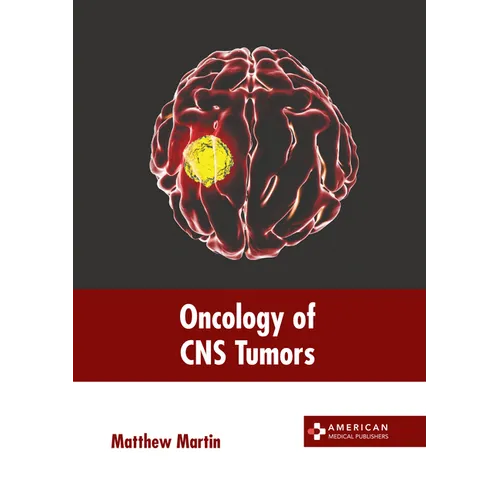 Oncology of CNS Tumors