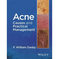 Acne: Causes and Practical Management