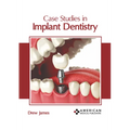 Case Studies in Implant Dentistry