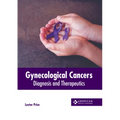 Gynecological Cancers: Diagnosis and Therapeutics