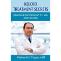 Keloid Treatment Secrets: What Your Doctor Wont Tell You.