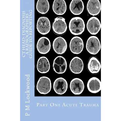 CT Head: DIAGNOSIS A Radiographers Guide To Reporting Part 1 Acute Trauma: Part One Acute Trauma