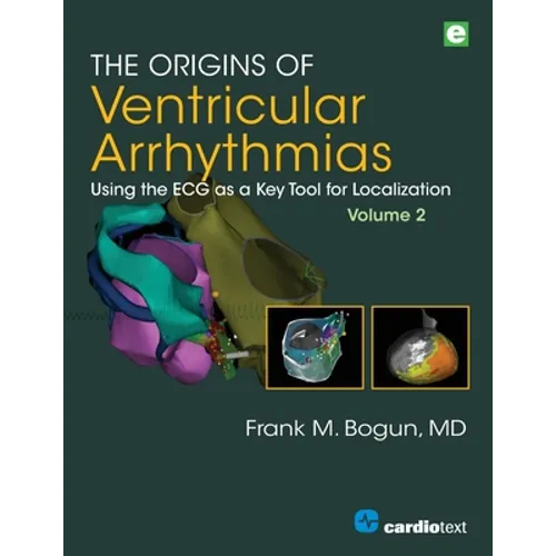 The Origins of Ventricular Arrhythmias, Volume 2: Using the ECG as a Key Tool for Localization, Volume 2