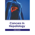 Cancers in Hepatology