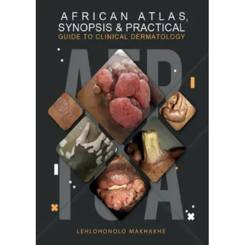 African Atlas, Synopsis & Practical Guide to Clinical Dermatology