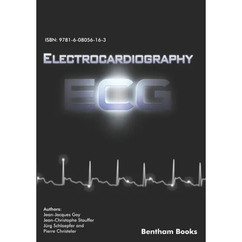 Electrocardiography (ECG)