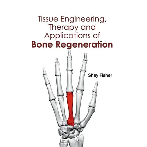 Tissue Engineering, Therapy and Applications of Bone Regeneration - Hardcover