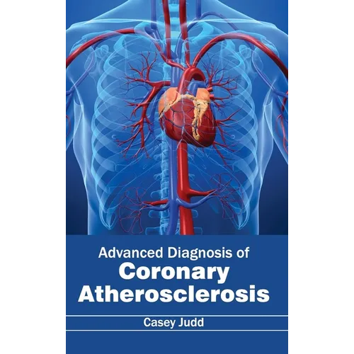 Advanced Diagnosis of Coronary Atherosclerosis