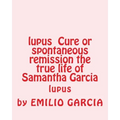 lupus Cure or spontaneous remission the true life of Samantha Garcia: lupus
