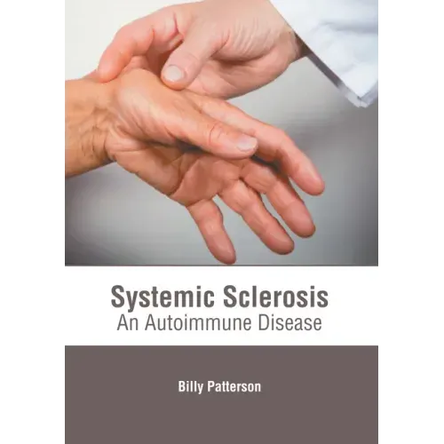 Systemic Sclerosis: An Autoimmune Disease