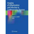 Imaging of Inflammation and Infection in Cardiovascular Diseases