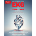 How to Correctly Answer EKG and Arrhythmia Questions: For Medical Students and Doctors Preparing for USMLE Step 1, Step 2 CK, and Step 3