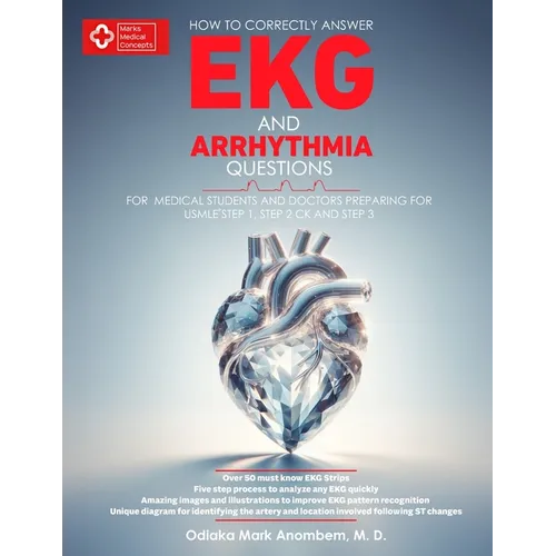 How to Correctly Answer EKG and Arrhythmia Questions: For Medical Students and Doctors Preparing for USMLE Step 1, Step 2 CK, and Step 3