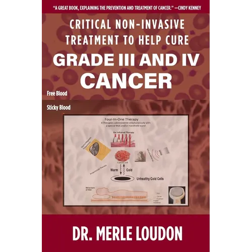Critical Non-Invasive Treatment to Cure Grade III and IV Cancer