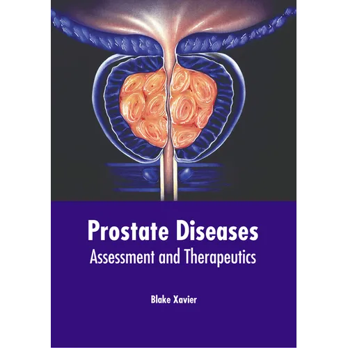 Prostate Diseases: Assessment and Therapeutics