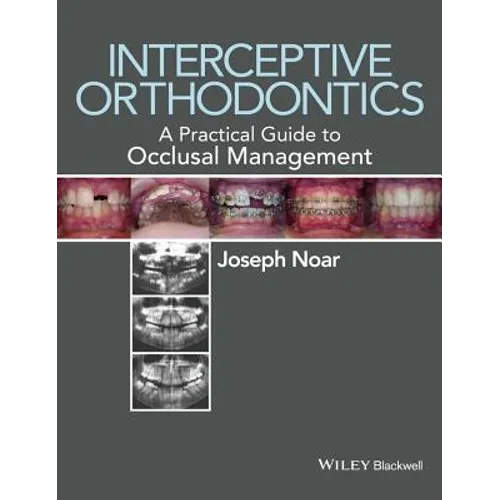 Interceptive Orthodontics: A Practical Guide to Occlusal Management