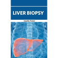 Liver Biopsy