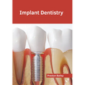 Implant Dentistry