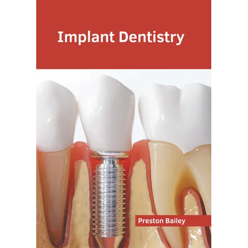 Implant Dentistry