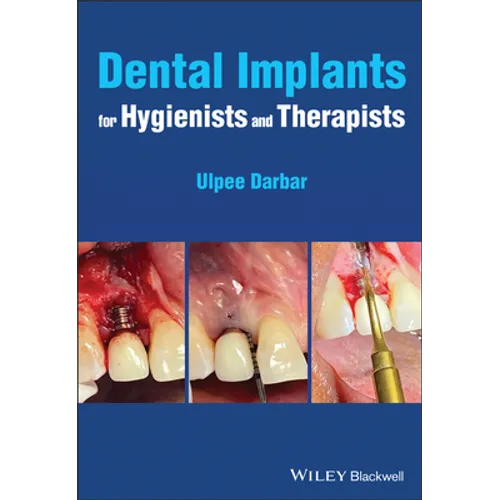Dental Implants for Hygienists and Therapists