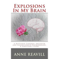 Explosions in My Brain: A Ruptures Cerebral Aneurysm and Subarachnoid Haemorrhage; A Surviver's Story