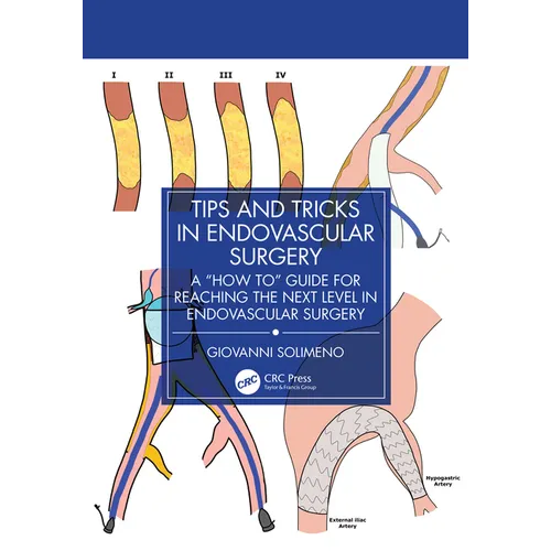 Tips and Tricks in Endovascular Surgery: A "How to" Guide for reaching the next Level in Endovascular Surgery