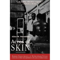 Acres of Skin: Human Experiments at Holmesburg Prison