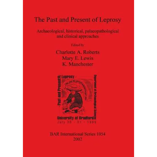 The Past and Present of Leprosy: Archaeological, historical, palaeopathological and clinical approaches
