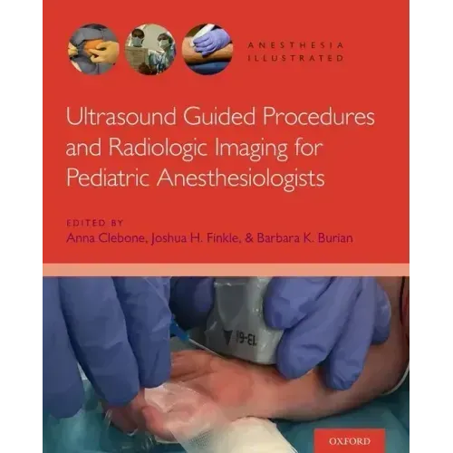 Ultrasound AI P