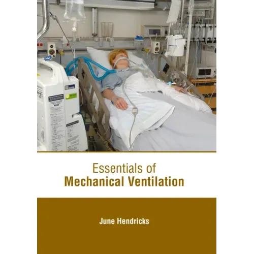 Essentials of Mechanical Ventilation